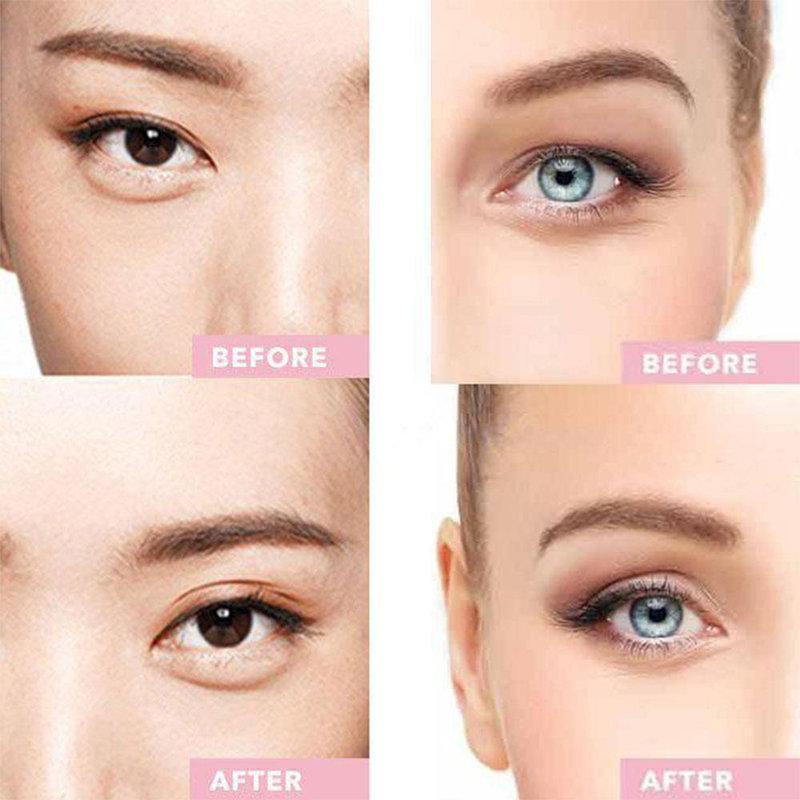 Dream Eyes? - Instant Eye Lift - 50% OFF TODAY